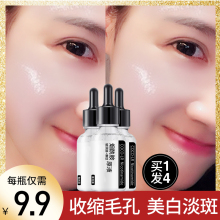 Whitening, spot lightening, niacinamide solution, pore shrinking, acne removing and acne mark lightening